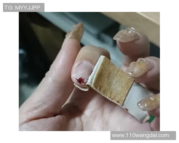 做了美甲后能否打篮球的注意事项与建议分享
